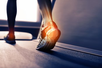 Grafik von zwei Füßen mit Schmerzen auf Laufband